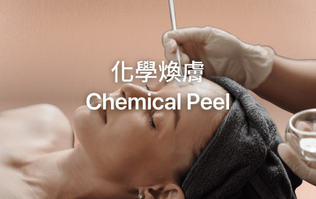 chemical peel
